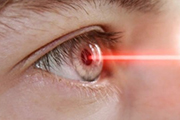 Sasszem alkalmassági vizsgálat